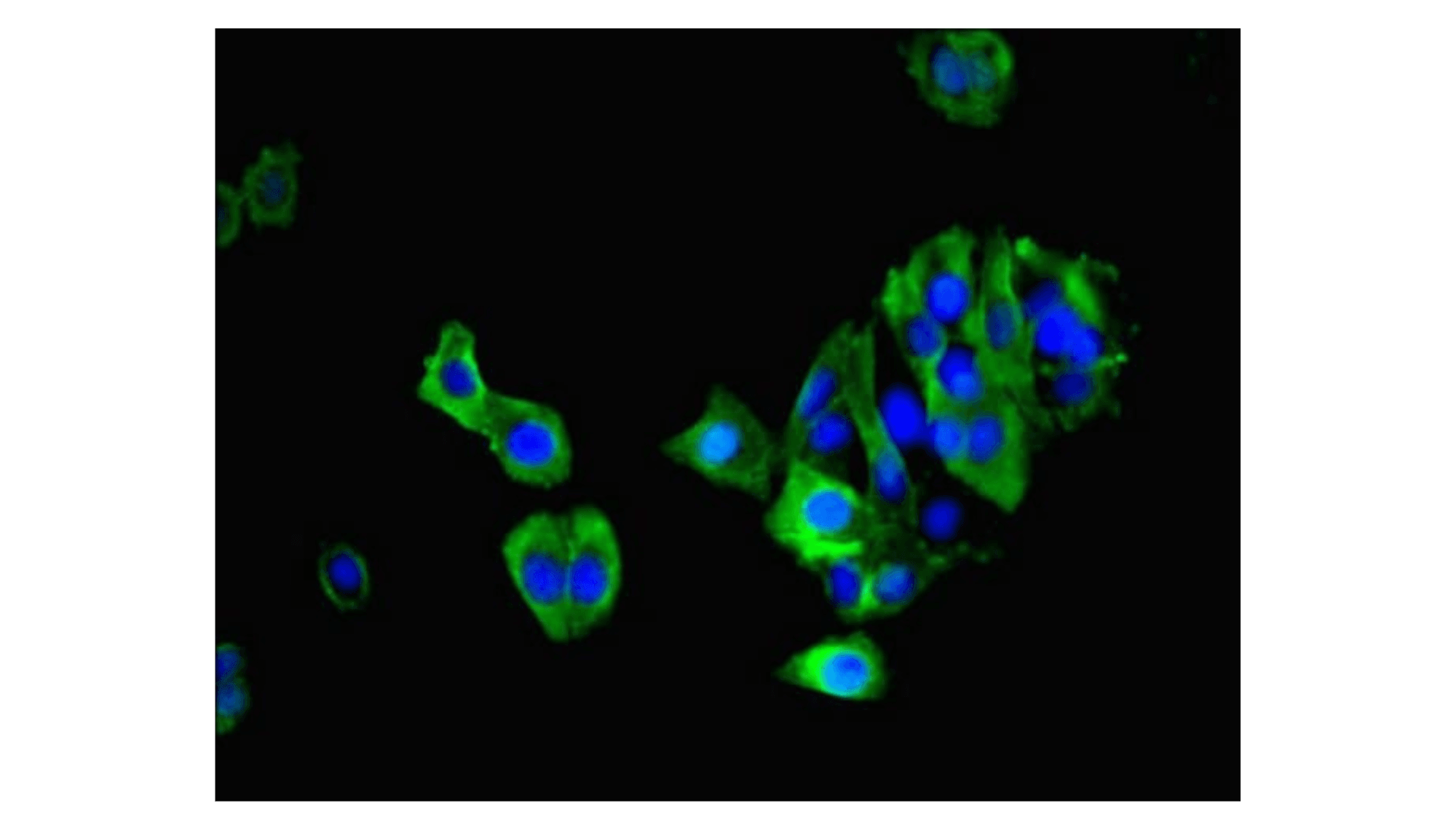 MAS1 receptor (MAS-R) autoantibody
